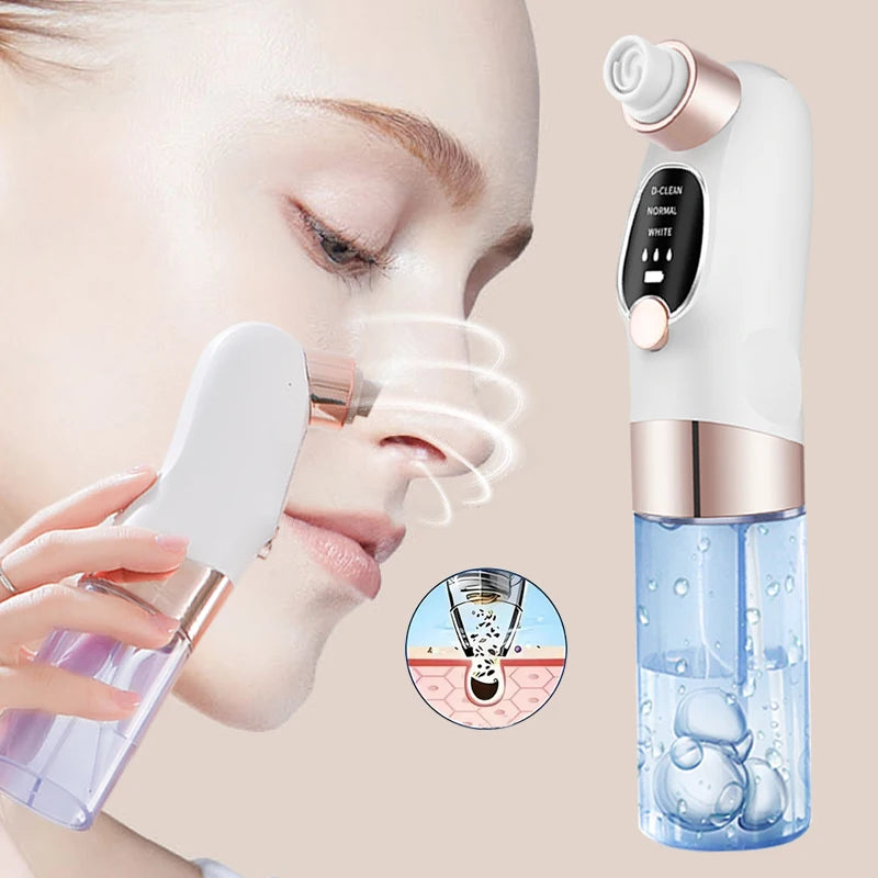 CharmMaxx Pore Vacuum — Electric Blackhead Remover